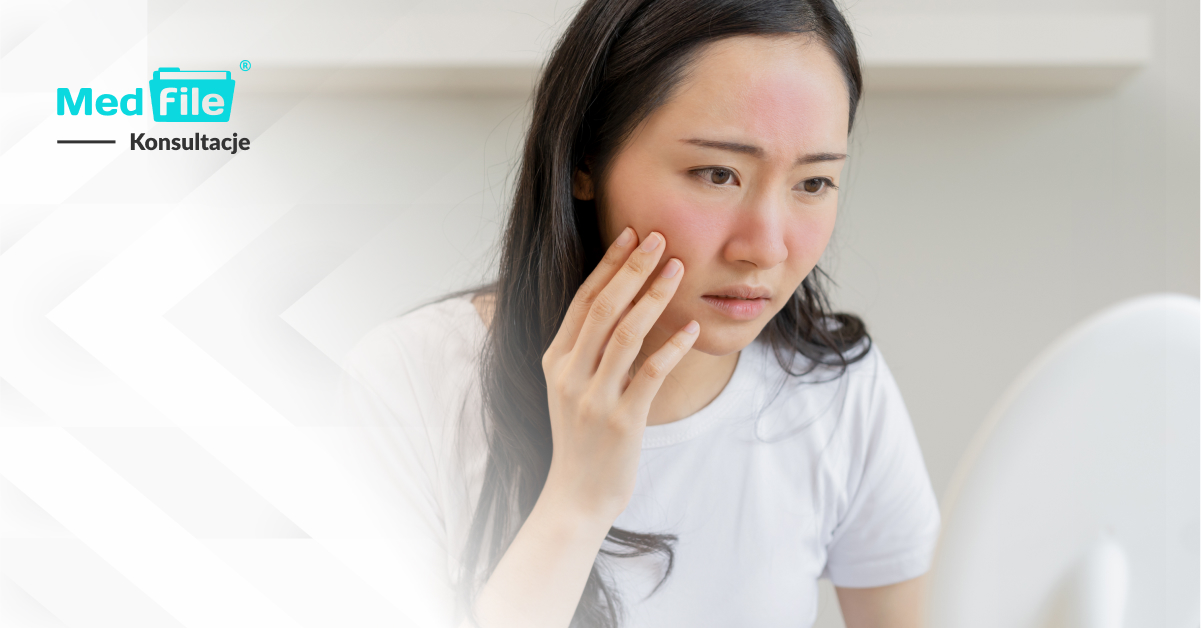 Trądzik różowaty: czym jest i jak go odróżnić od zwykłego trądziku?