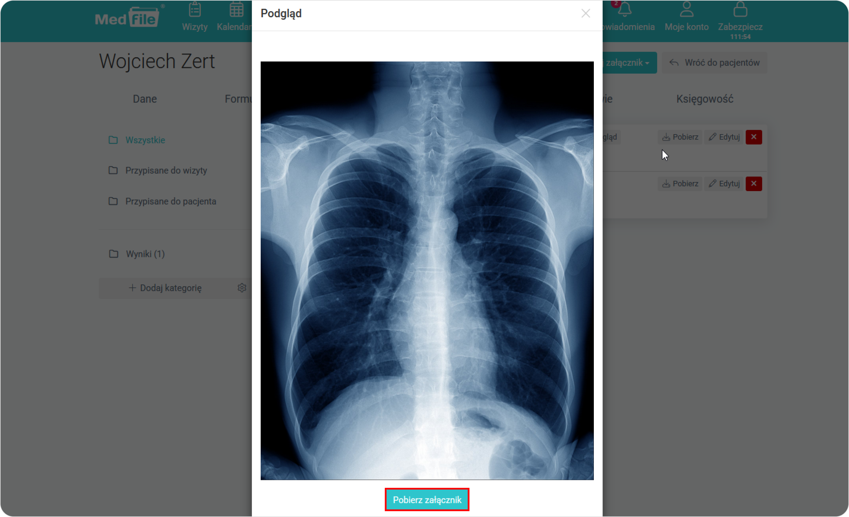 Sprawdź podgląd załącznika